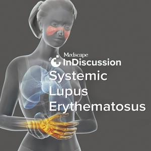 Medscape InDiscussion: Systemic Lupus Erythematosus